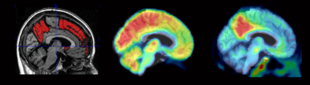 3-brains 3-brains